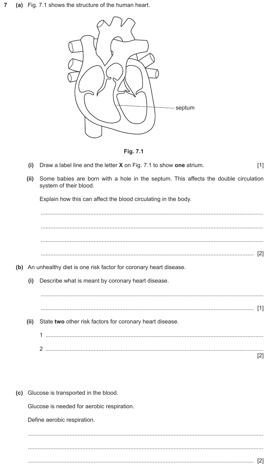 IGCSE 0653 May/Jun 2023 Paper 43 Q7 — Transport in Animals