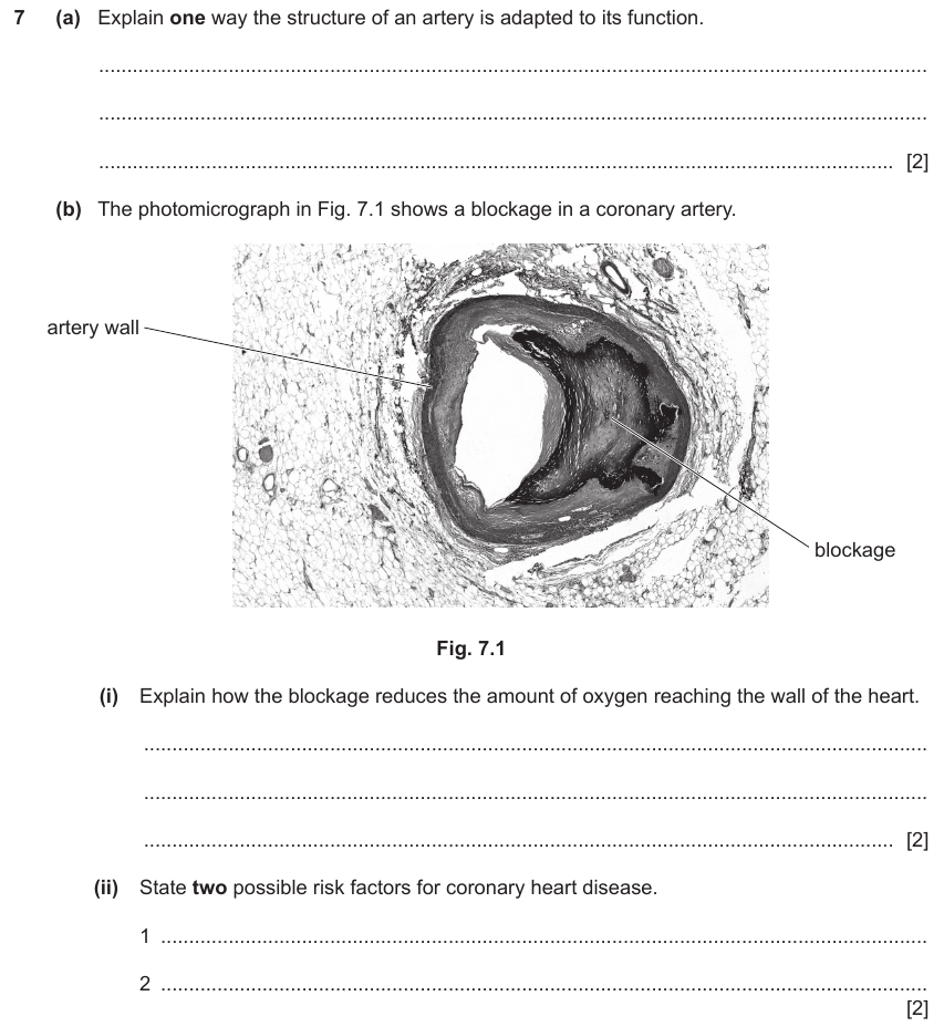 IGCSE 0653 Oct/Nov 2023 Paper 42 Q7 — Transport in Animals