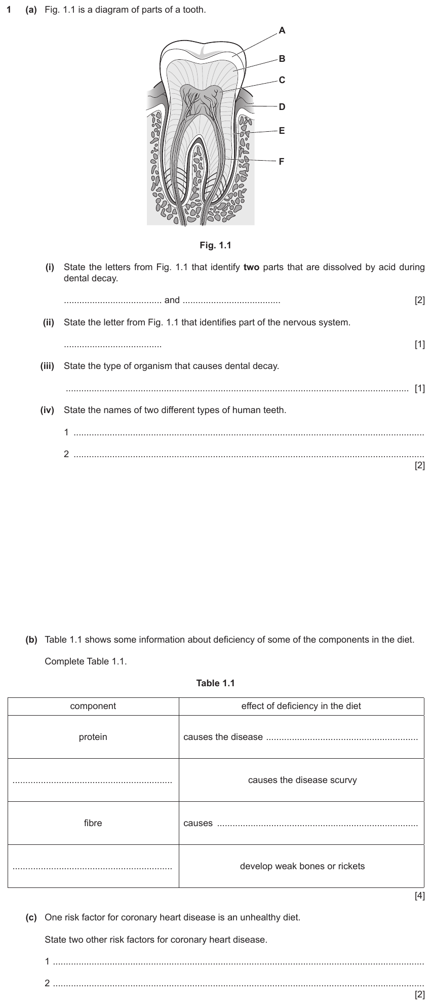 IGCSE 0654 Jun 2023 Paper 43 Question 1 — Heart & circulatory system