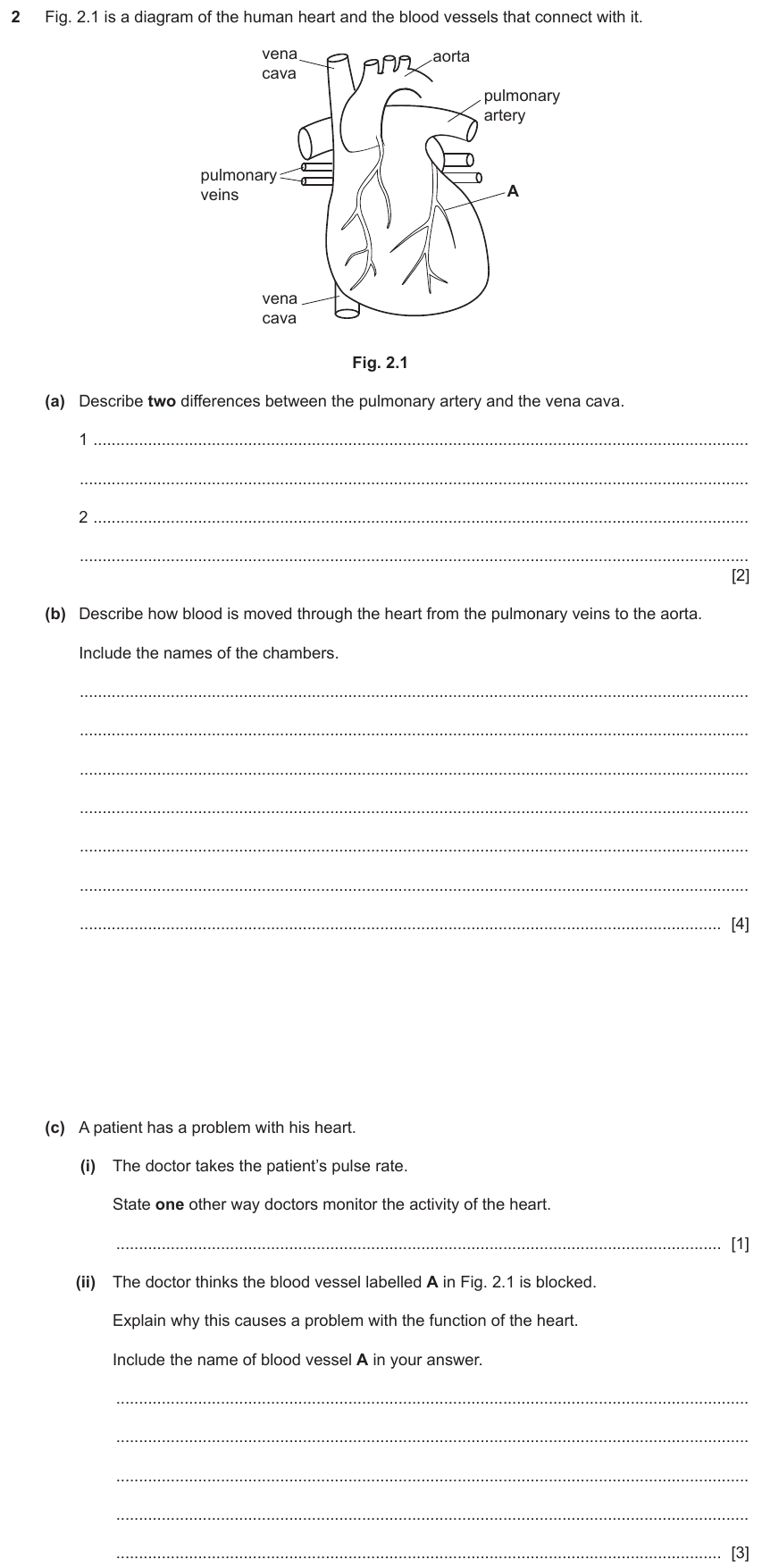 IGCSE 0654 Jun 2025 Paper 41 Question 2 — Blood vessels