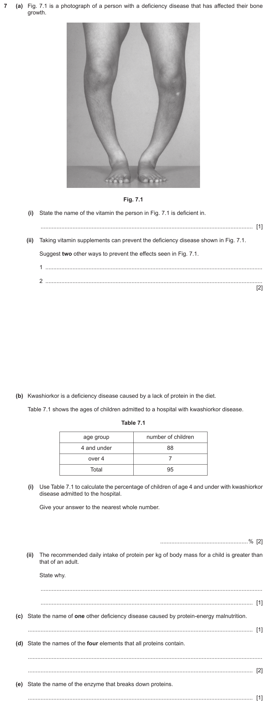 IGCSE 0654 Nov 2022 Paper 41 Question 7 — Balanced diet