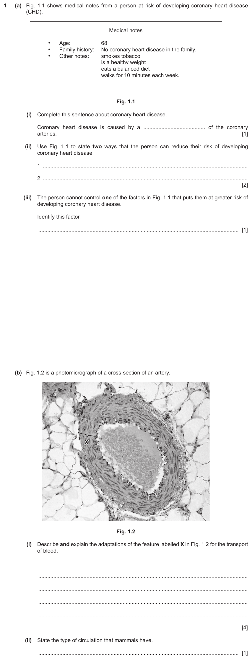 IGCSE 0654 Nov 2023 Paper 43 Question 1 — Heart & circulatory system